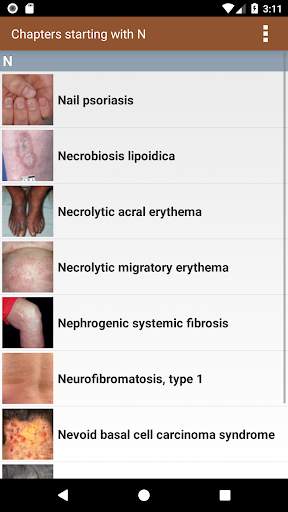 Lebwohl's Treatment of Skin Disease, 5th Edition screenshot 2