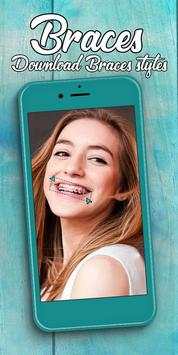 Braces screenshot 8