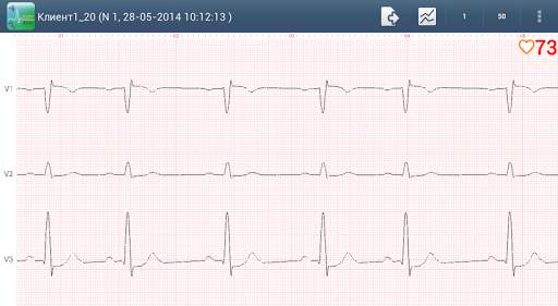 Easy ECG Mobile PRO screenshot 3
