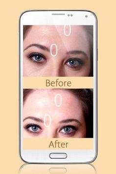 Photo Editor Blemish screenshot 1