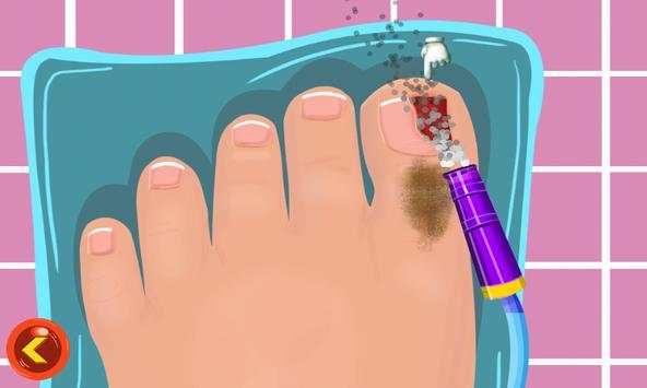 Toe Surgery Doctor Game screenshot 3