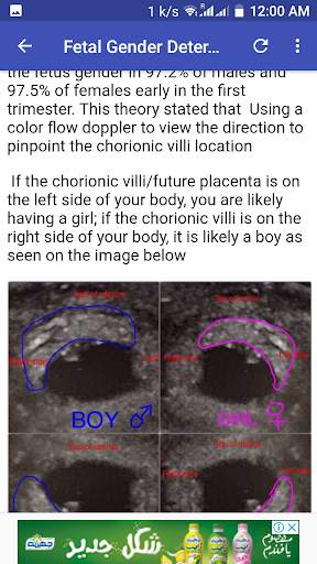 Ultrasound Guide A2Z screenshot 3