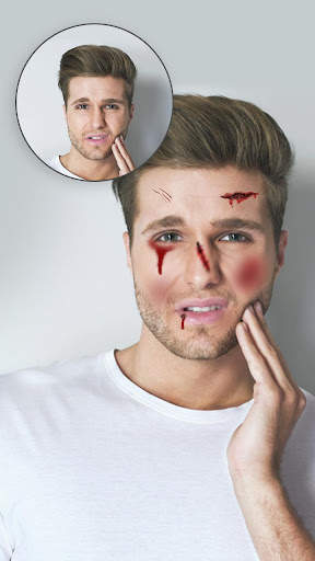 Injury on Face Photo Maker screenshot 2