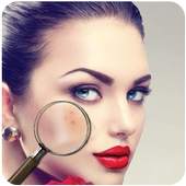 Pimple Remover 1.0.2