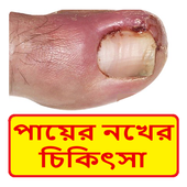 নখের কোনা ওঠা চিকিৎসা ~ Nail Treatment icon