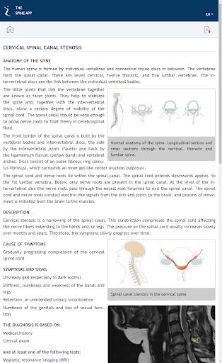THE SPINE APP screenshot 3