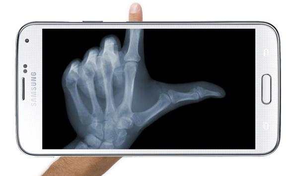 X Ray Scanner Prank screenshot 2