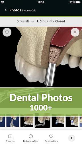 DentiCalc 4in1: Dental Care Tool for Dentists screenshot 6