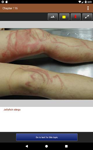 Lebwohl's Treatment of Skin Disease, 5th Edition screenshot 12