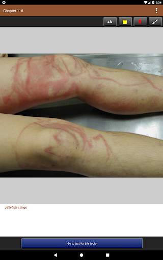 Lebwohl's Treatment of Skin Disease, 5th Edition screenshot 20