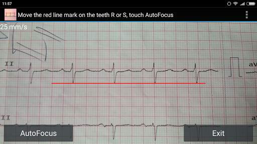 ECG Reader free screenshot 1