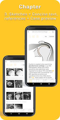 MRI Essentials screenshot 3