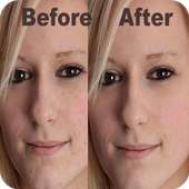 Photo Edit Blemishes - How to logo
