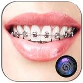 Braces Photo Editor Beauty 1.04