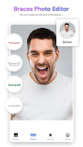 Braces Photo screenshot 3