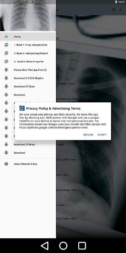 Medical X-Ray Interpretation w screenshot 1