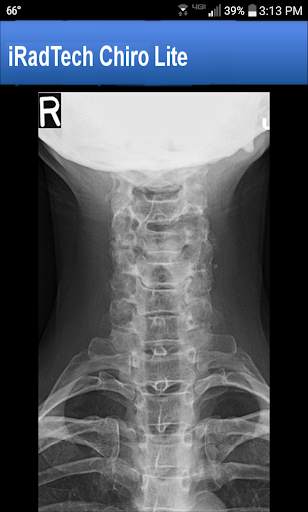 iRadTech Chiro Lite screenshot 11
