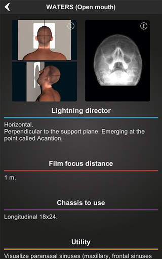 RX - Radiographic Positioning screenshot 9