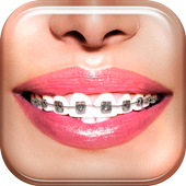 Braces icon