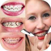 Fake Braces  Photo Editor icon