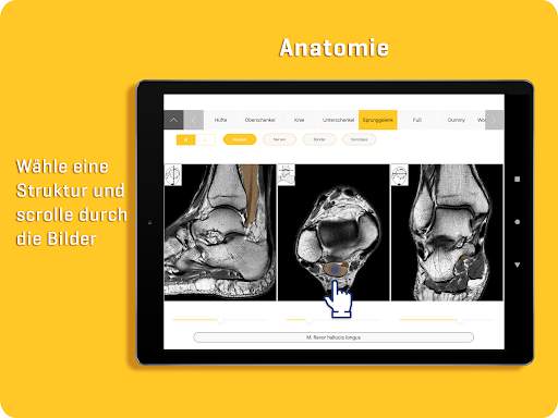 MRI Essentials screenshot 13