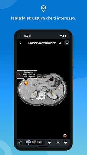 e-Anatomy screenshot 4