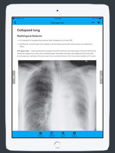 CXR FlashCards - Reference app for Chest X-rays screenshot 8