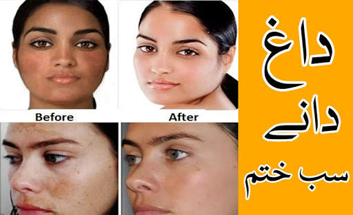 Rang gora karne ki tips in urdu screenshot 3