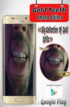 Gold Teeth Photo Editor screenshot 1