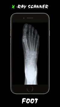 X - Ray Scanner screenshot 5