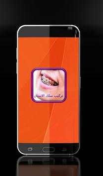 تركيب الاسنان - تقويم الأسنان 2 تصوير الشاشة