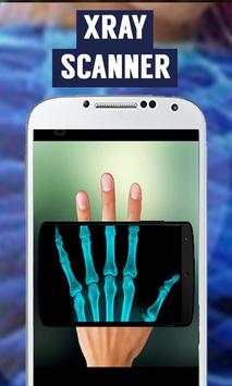 Xray Camera Scanner screenshot 1