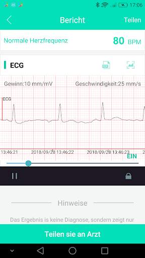SnapECG screenshot 4