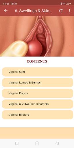 All Vaginal Problems & Solutio screenshot 6