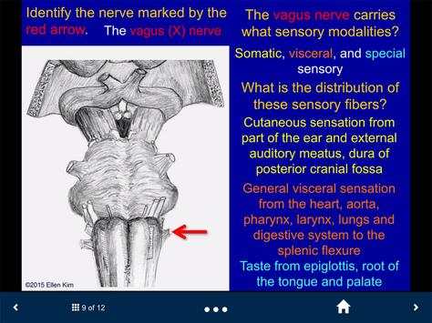 Neuroanatomy Lite - SecondLook screenshot 4