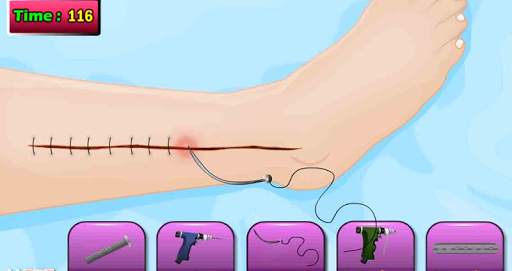 Doktor Tom Beinoperation Spiel screenshot 11