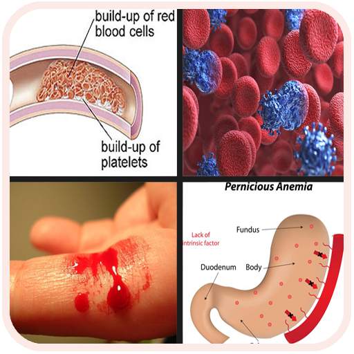 All Blood Disease & Treatment 13.10.33p