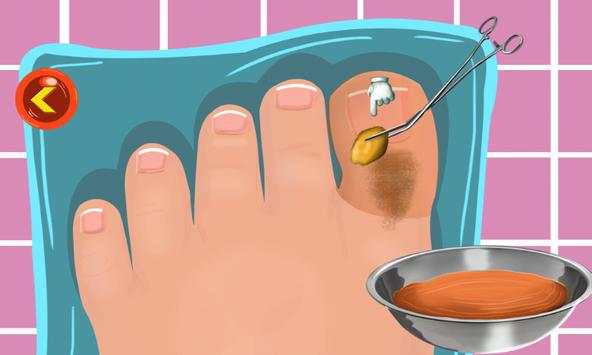 Toe Surgery Doctor Game screenshot 4