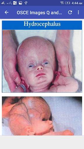 Pediatrics  OSCE Q and A screenshot 6