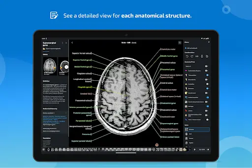 e-Anatomy screenshot 13
