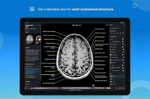 e-Anatomy screenshot 13