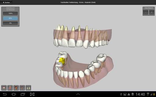 CGM VISODENT 3D App screenshot 1