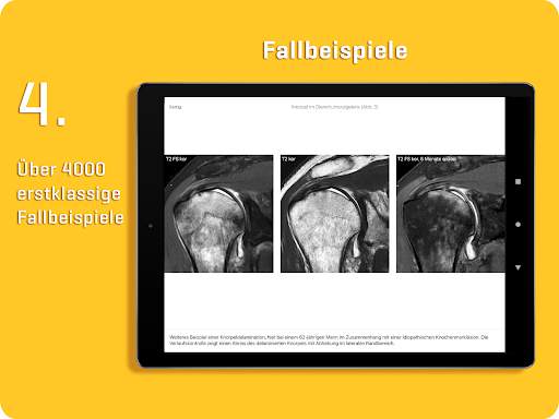 MRI Essentials screenshot 11