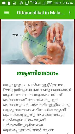 Ottamoolikal in Malayalam screenshot 4