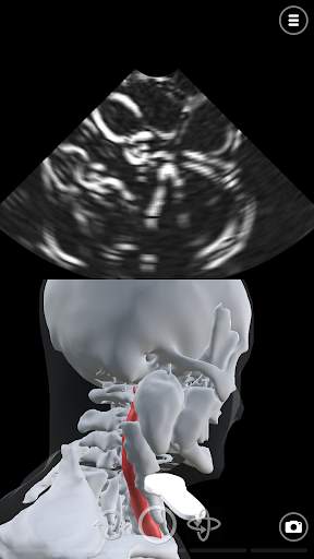 Deepscope Ultrasound Simulator screenshot 5