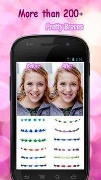 Braces screenshot 1