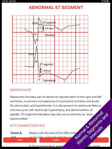 ECG FlashCards 2 Lite - Free Reference EKG App screenshot 1