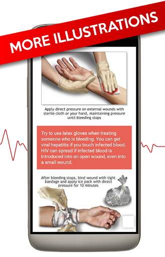 First Aid Guide - Offline📖 screenshot 3