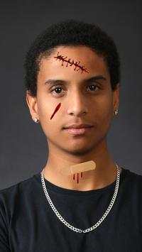 Injury Photo Editor screenshot 2