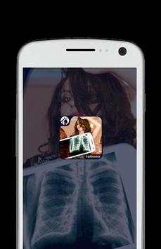 Xray Camera Funny Prank screenshot 3